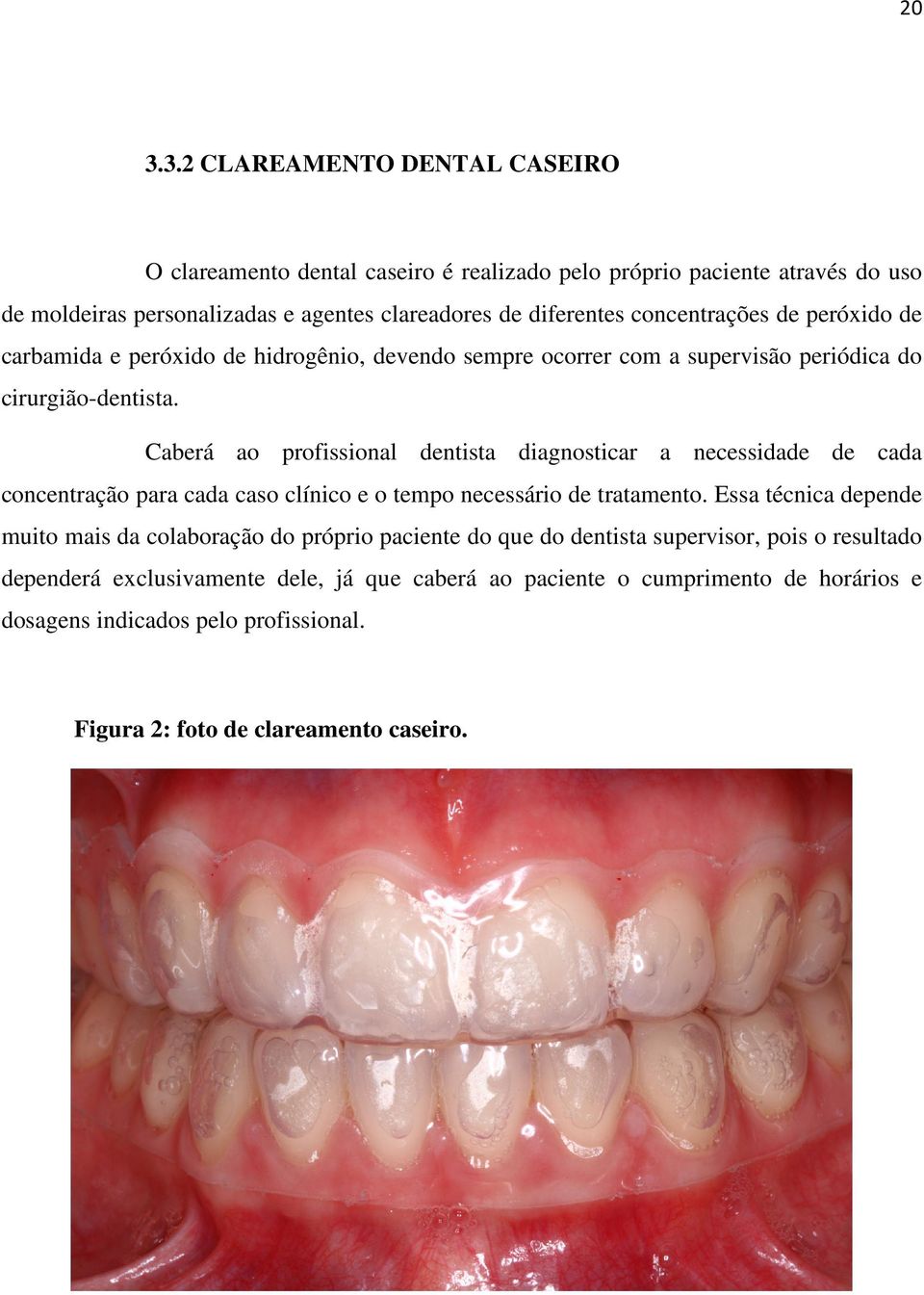 Caberá ao profissional dentista diagnosticar a necessidade de cada concentração para cada caso clínico e o tempo necessário de tratamento.