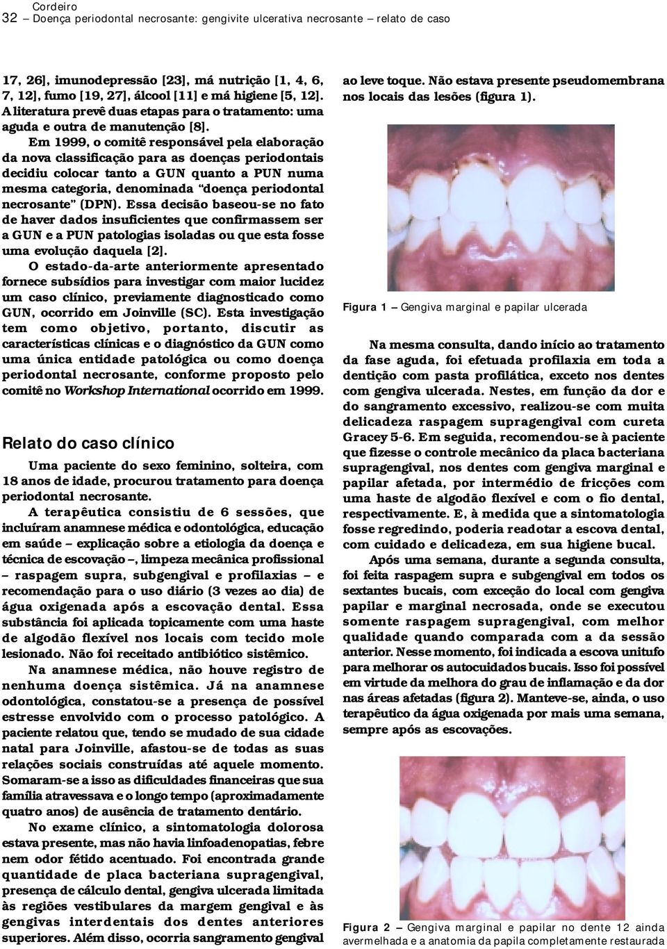 Em 1999, o comitê responsável pela elaboração da nova classificação para as doenças periodontais decidiu colocar tanto a GUN quanto a PUN numa mesma categoria, denominada doença periodontal