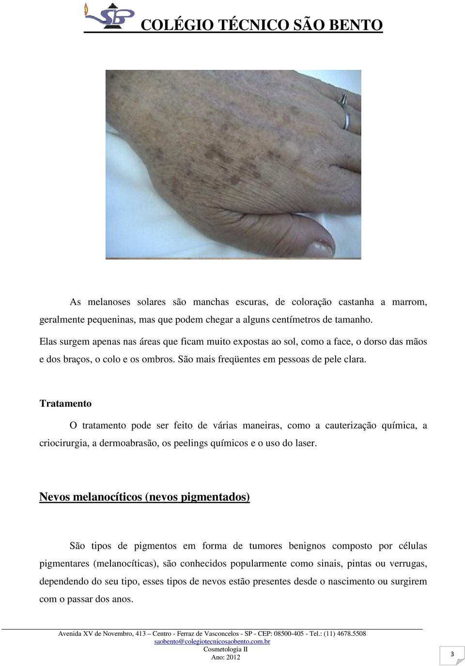 Tratamento O tratamento pode ser feito de várias maneiras, como a cauterização química, a criocirurgia, a dermoabrasão, os peelings químicos e o uso do laser.