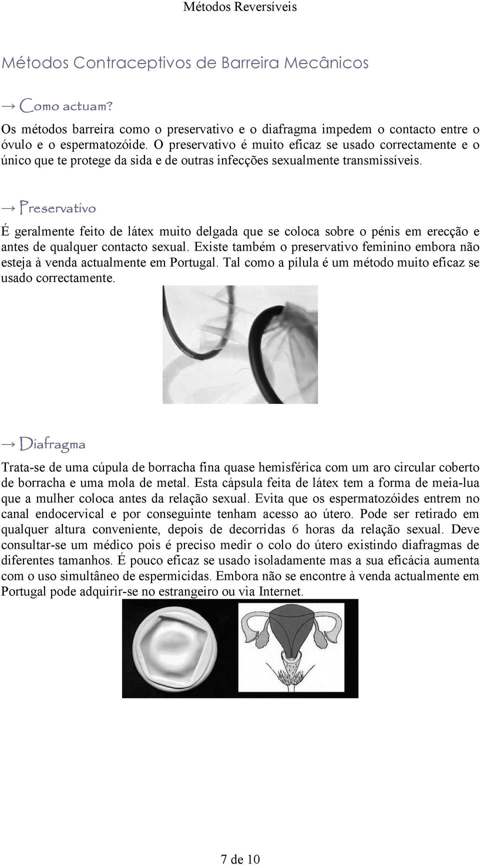 Preservativo É geralmente feito de látex muito delgada que se coloca sobre o pénis em erecção e antes de qualquer contacto sexual.