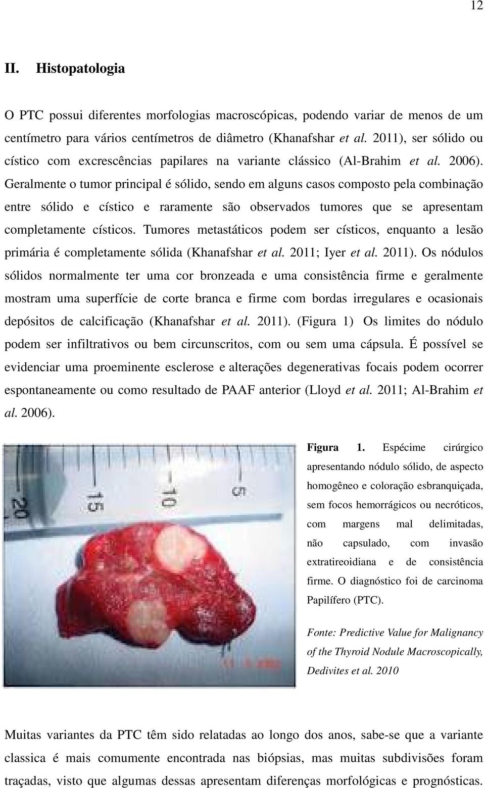 Geralmente o tumor principal é sólido, sendo em alguns casos composto pela combinação entre sólido e cístico e raramente são observados tumores que se apresentam completamente císticos.