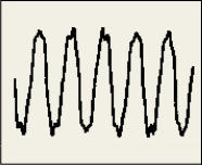 Figura 14: Distorção harmônica de tensão Também podem ocorrer as inter-harmônicas que são tensões ou correntes com uma freqüência que não é um múltiplo inteiro da freqüência fundamental da