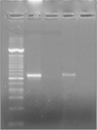 oligonucleotídeos no gene 18S rrna do Hepatozoon sp. (Figura 3).