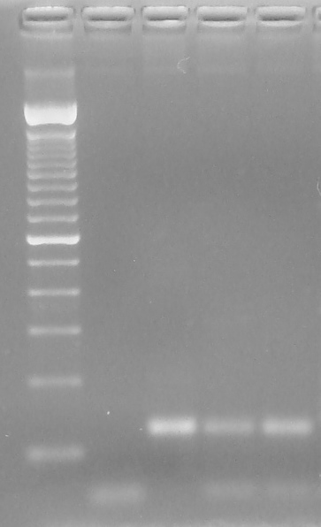 1 2 3 4 5 600 pb 300 pb 100 pb 120 pb Figura 6. Resultado da PCR para o gênero Leishmania sp. utilizando-se os oligonucleotídeos LFW e LBW1 e 2.