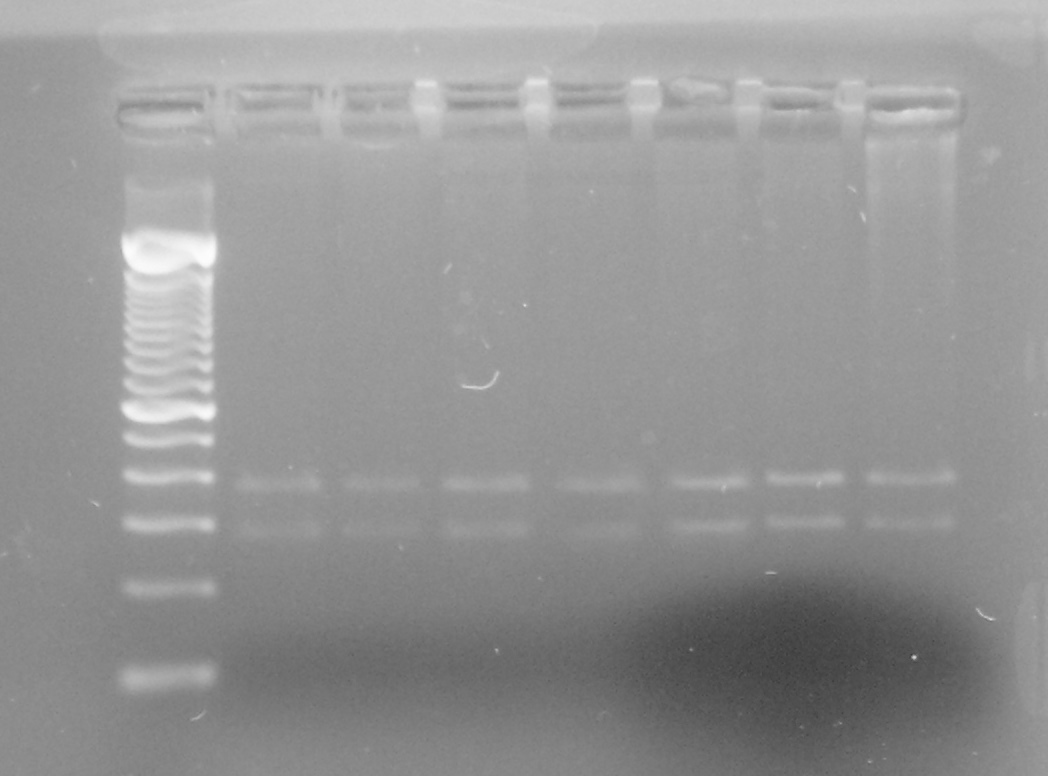 1 2 3 4 5 665 pb 600 pb 300 pb 100 pb Figura 7. Resultado da PCR para o gênero Hepatozoon sp. utlizando-se os oligonucleotídeos Hep-1 e Hep-4.