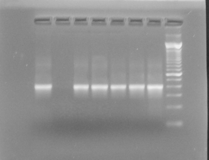 1 2 3 4 5 6 7 8 600pb 400pb 300pb 100pb Figura 9. Resultado da PCR para o gene da enzima GAPDH, utilizando os primers GAPDH-F e GAPDH-R.