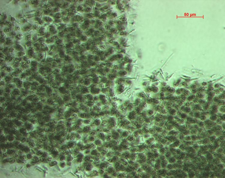 Microcystis