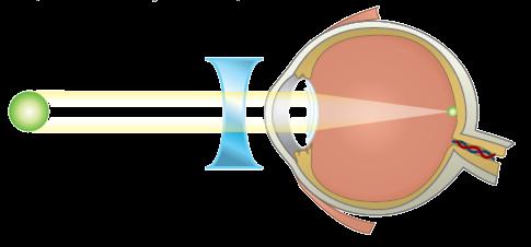 esféricos Espelho convexo Espelho côncavo Lentes esféricas