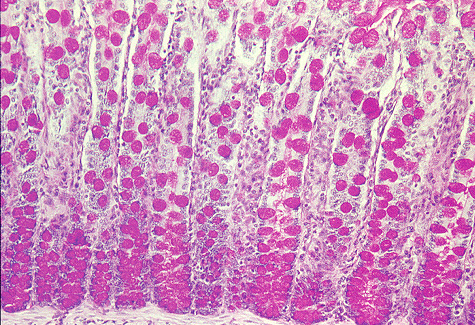 Parte mucosa do