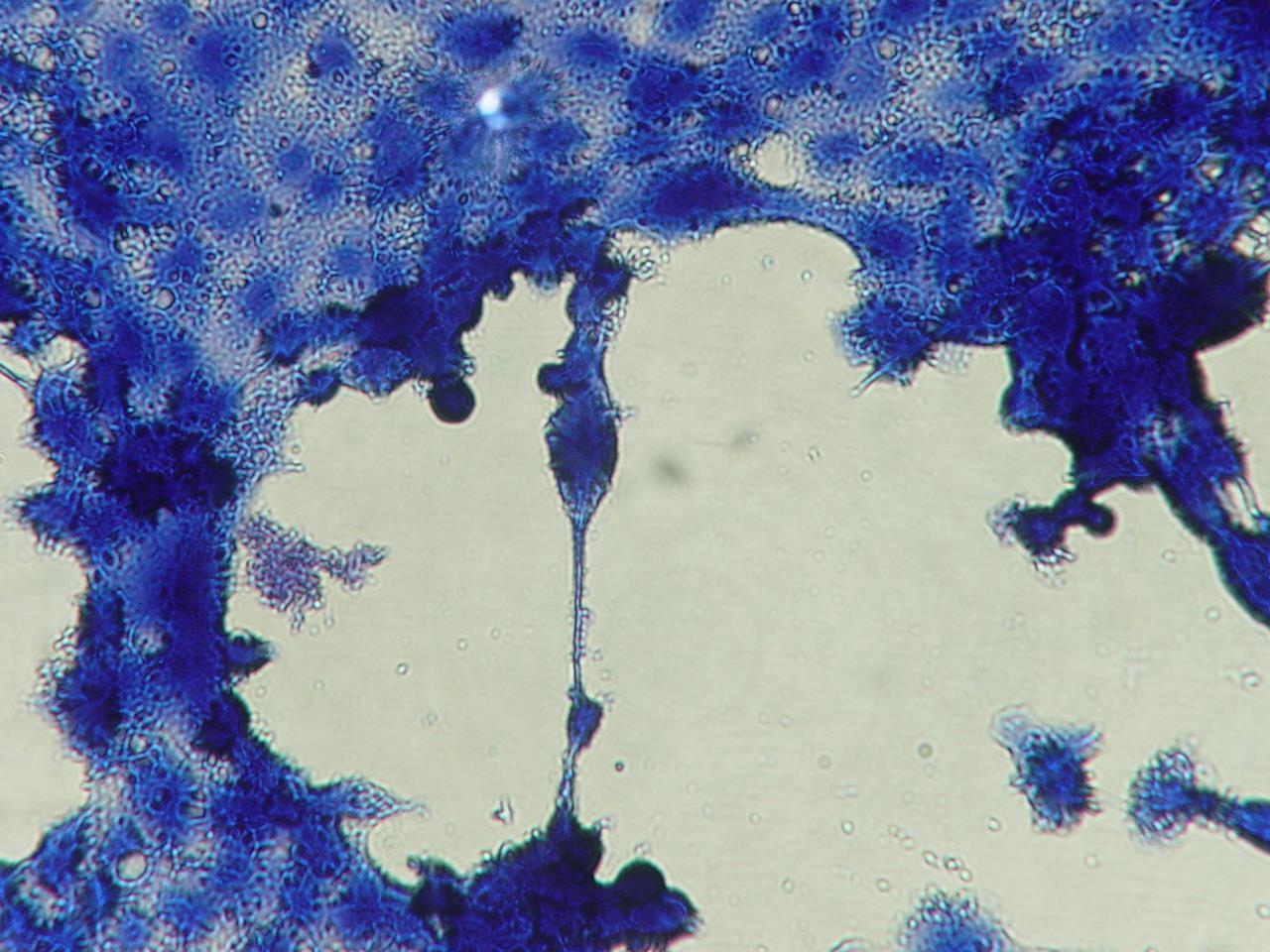 EFEITO CITOPÁTICO (ECP): Herpes