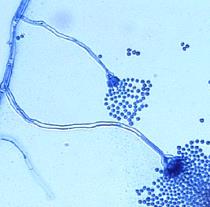 Pezizomycotina (= Euascomycetes) + de 90% das spp. de Ascomycota (32.000 spp.) Espécies sapróbias e parasitas - filamentosas Penicillium penicilina (P. chrysogenum) queijos (P. roqueforti, P.