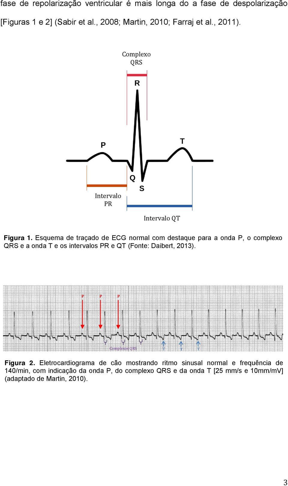 Esquema de traçado de ECG normal com destaque para a onda P, o complexo QRS e a onda T e os intervalos PR e QT (Fonte: Daibert, 2013).