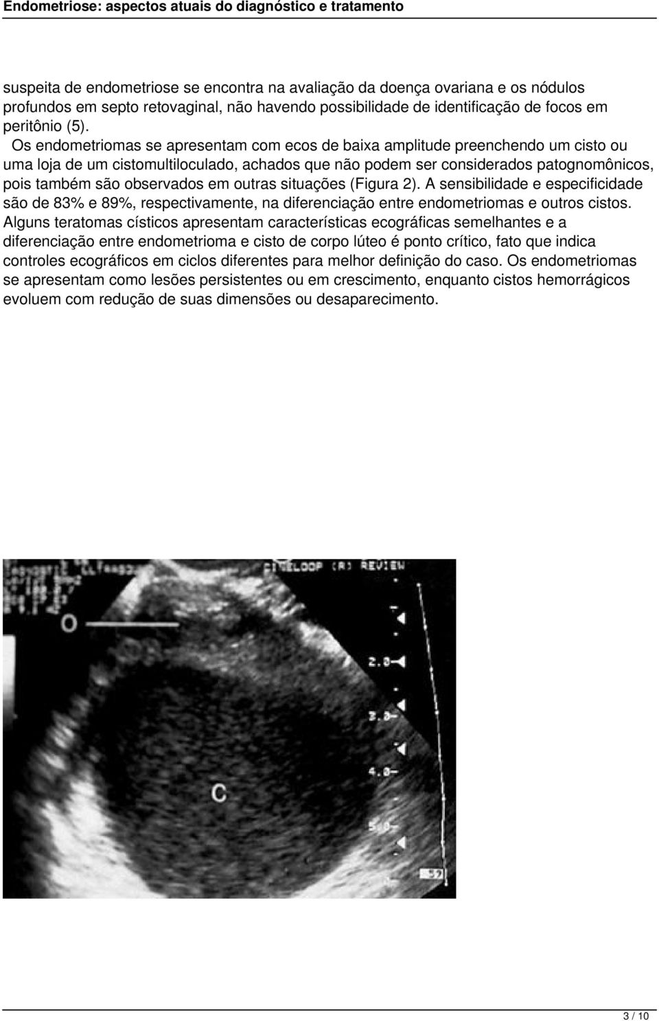 em outras situações (Figura 2). A sensibilidade e especificidade são de 83% e 89%, respectivamente, na diferenciação entre endometriomas e outros cistos.