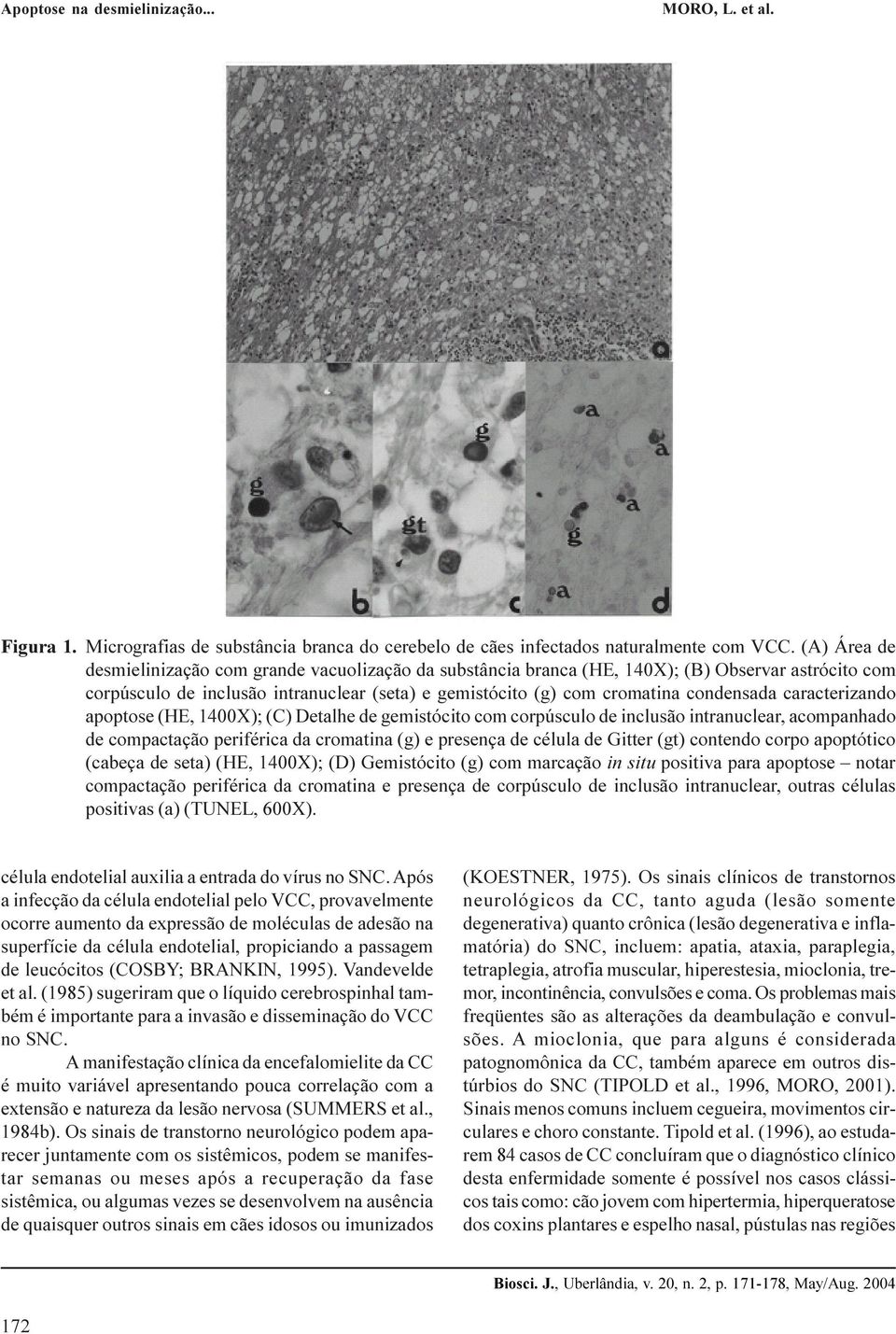 caracterizando apoptose (HE, 1400X); (C) Detalhe de gemistócito com corpúsculo de inclusão intranuclear, acompanhado de compactação periférica da cromatina (g) e presença de célula de Gitter (gt)