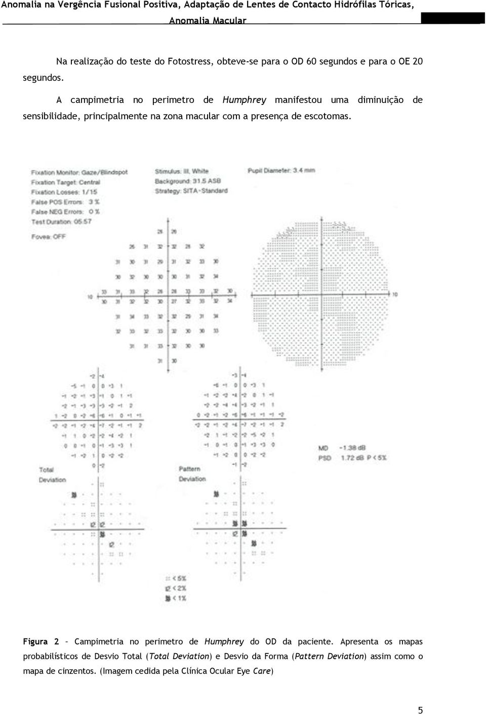 presença de escotomas. Figura 2 Campimetria no perimetro de Humphrey do OD da paciente.