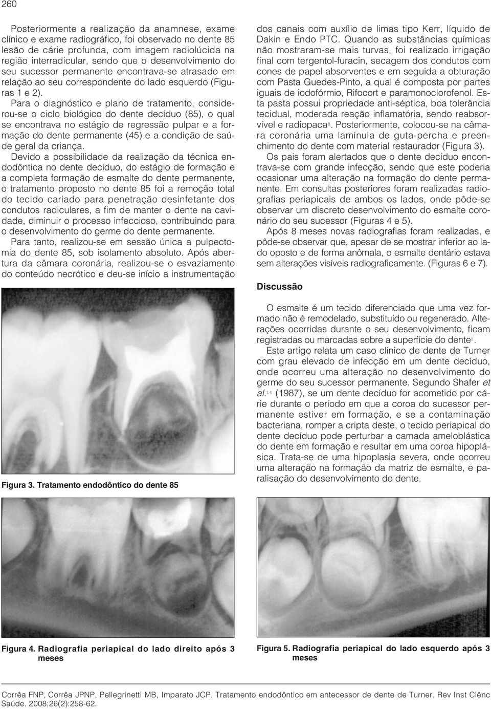Para o diagnóstico e plano de tratamento, considerou-se o ciclo biológico do dente decíduo (85), o qual se encontrava no estágio de regressão pulpar e a formação do dente permanente (45) e a condição