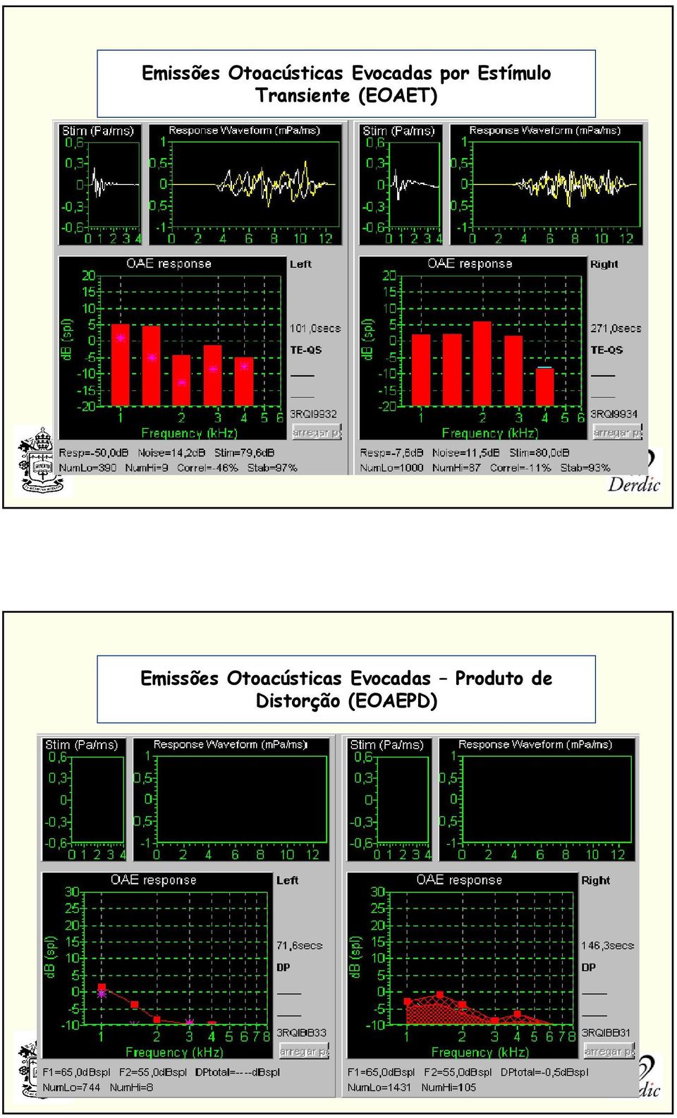 (EOAET)  Produto de Distorção