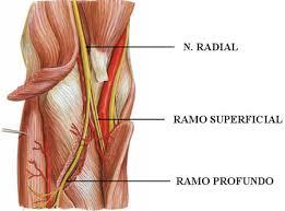 COMPRESSÃO DO NERVO RADIAL NERVO RADIAL