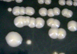 30 apresentam microscopicamente na forma de blastoconídios, brotantes ou não (Figura 04), e na macroscopia são observadas colônias brancas ou cremes, glabrosas, úmidas, sem pigmento e sem relevo