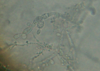 32 (Fonte: CEMM, 2005) Figura 08. Micromorfologia de Candida tropicalis: pseudomicélio com blastoconídios distribuídos em cadeias simples ou ramificadas. (Fonte: CEMM, 2007) Figura 09.