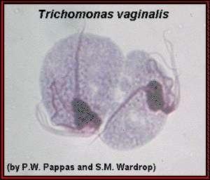 TRICOMANÍASE AGENTE: Trichomonas vaginalis TRANSMISSÃO: contato sexual com portador, uso de sanitários e roupas.