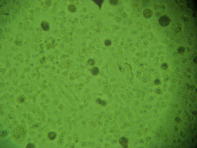 33 Figura 7 Folículos pré-antrais (setas) isolados de ovários de fêmeas suínas após processamento mecânico observados em microscópio invertido 200x.