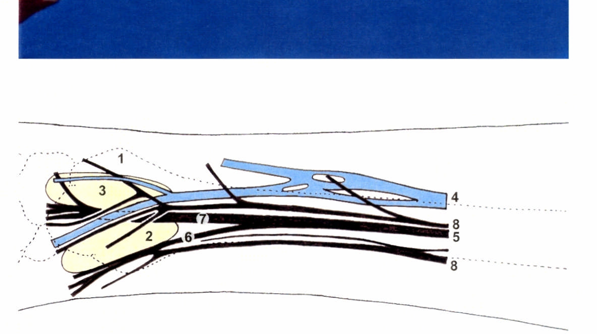 106 FIGURA 17 - Vista lateral doantebraço direito: 1. tubérculo dorsal do rádio; 2. conjunto de tendões dos músculos abdutor longo e extensor curto do polegar; 3.