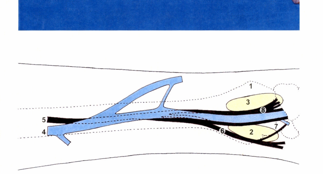 FIGURA 7 - Vista lateral do antebraço esquerdo: 1. tubérculo dorsal do rádio;2.conjunto de tendões dos músculos abdutor longo e extensor curto do polegar;3.