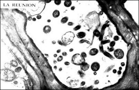 CVC CVC x HLB Xylella 10 6 cels/g tecido Garnier et al, 1990 Cigarrinha HLB Garcia et