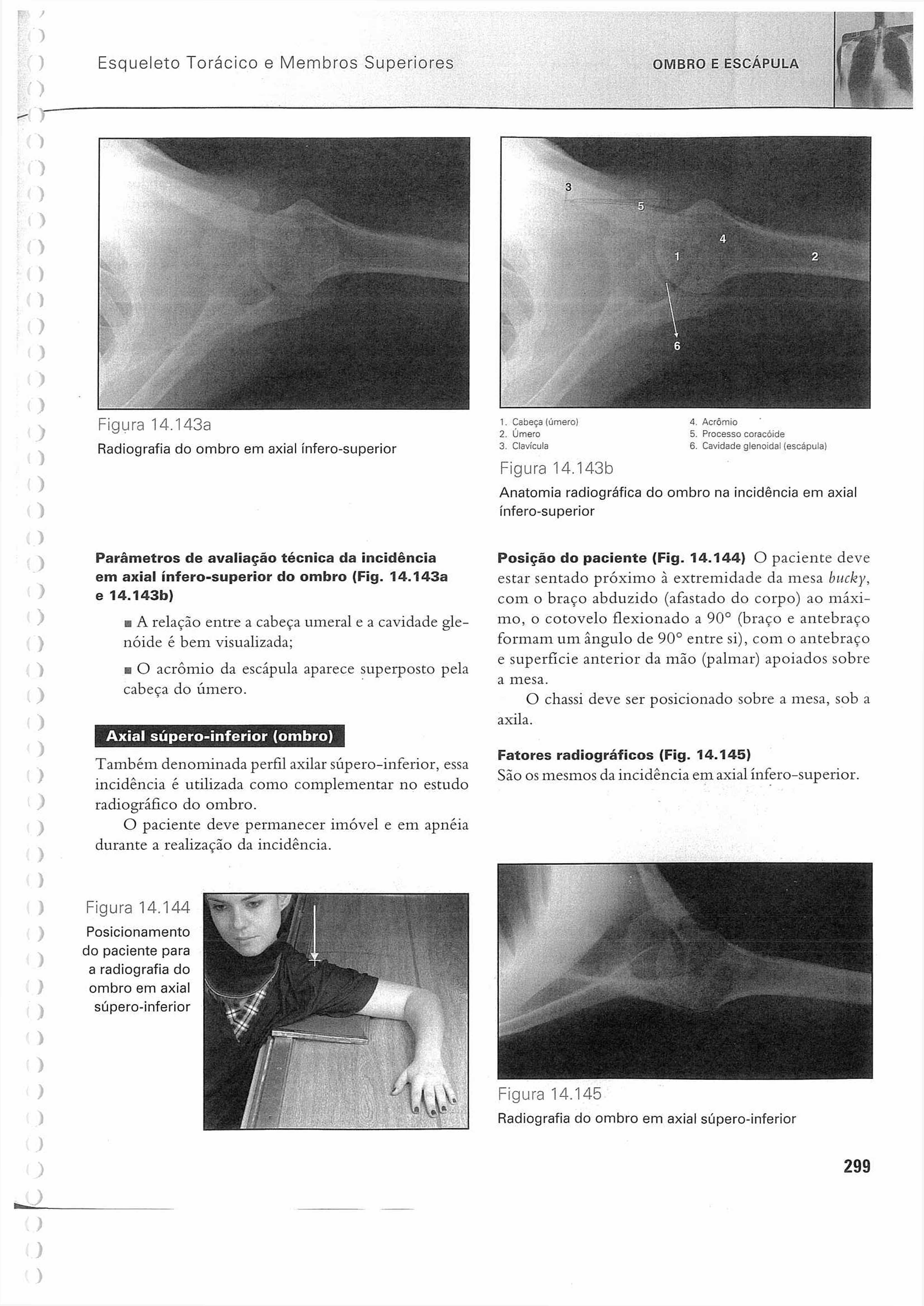 Esqueleto Torácico e Membros Superiores OMBRO E Figura 14.143a Radiografia do axial ínfero-superior Figura 14.143b 4. Acrômio 5. Processo coracóíde 6.