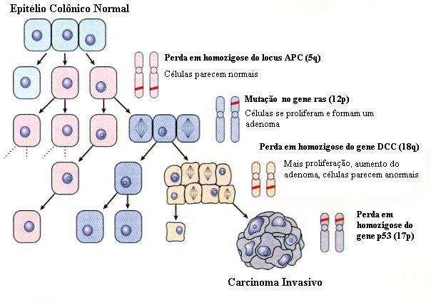 casos de CCR esporádico e da polipose adenomatosa familiar (Wilmink, 1997).