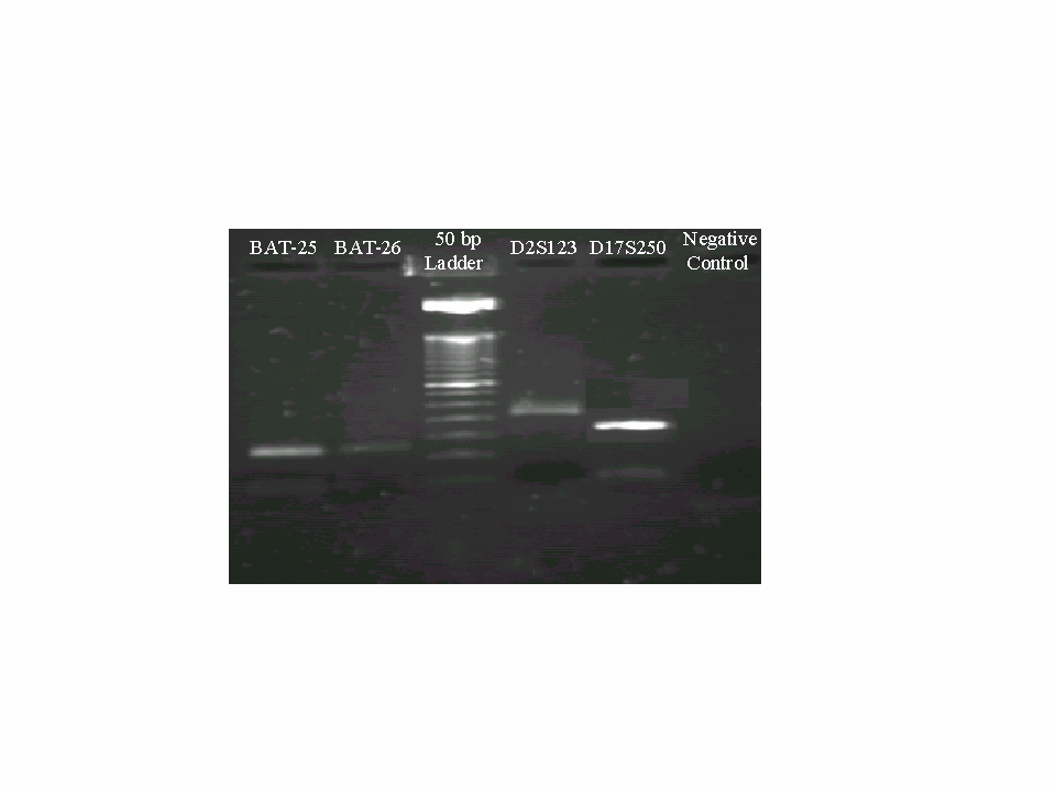 Table 1 PCR amplification of different-sized DNA fragments after extraction from tamponated formalin-fixed paraffin-embedded tissue.