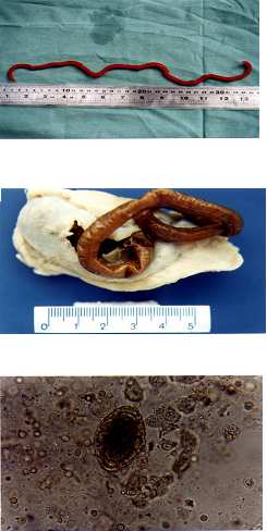 Lesões anatomopatológicas presentes na infecção por Dioctophyma renale (GOEZE, 1782) em cães domésticos... 97 Sete helmintos foram encontrados no rim direito e quatro na cavidade peritoneal.