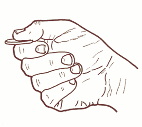 25 dorsal (Figura 10), o flexor curto do polegar (Figura 11), o primeiro interósseo palmar (Figura 10) e sobretudo, o adutor do polegar (Figura 12).