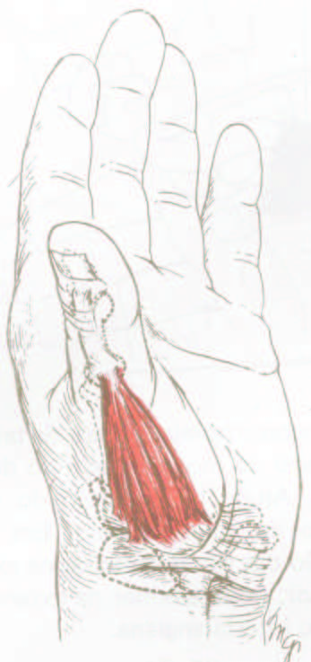 28 ( a ) ( b ) ( c ) Figura 11: Representação dos músculos da eminência tenar: (a) músculo abdutor curto do polegar, (b)