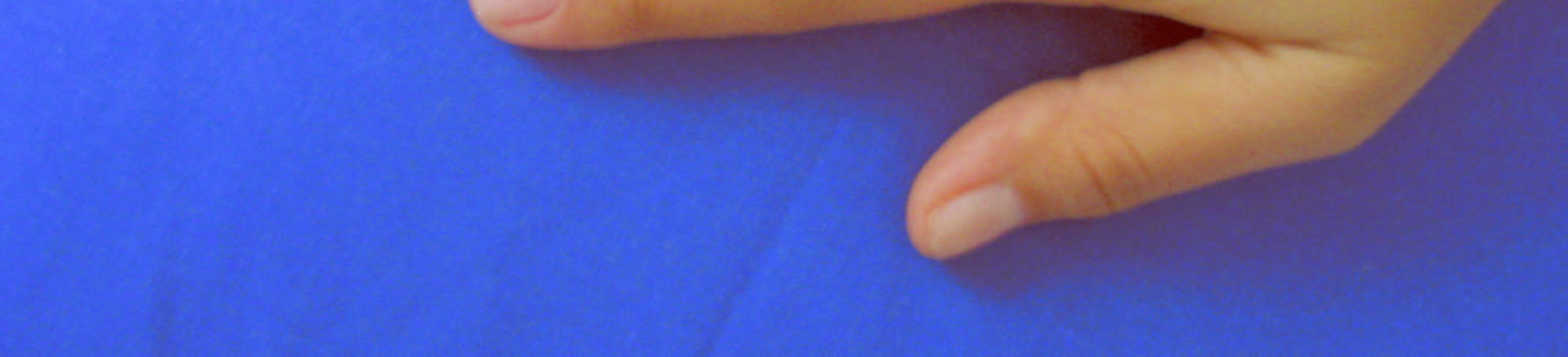 54 4. Comprimento do Dedo Médio: É a distância em linha reta entre o phalangion e o daktilion desse dedo (Figuras 23 e 24); Figura 23: