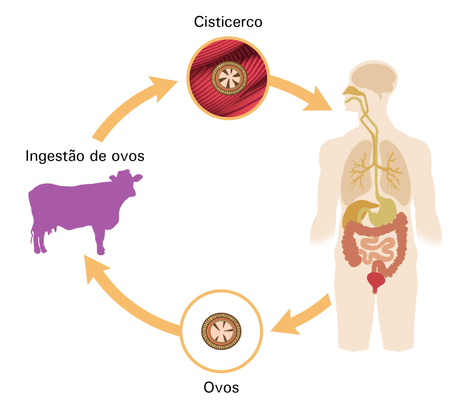 162 Licenciatura em Ciências USP/Univesp Módulo 5 A cisticercose é causada pela ingestão acidental dos ovos da Taenia solium.