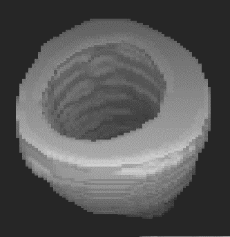 Aplicação : Quantificação Área Volume Distância 3D Curva de evolução temporal Índices 1 variação (fração de ejeção,.