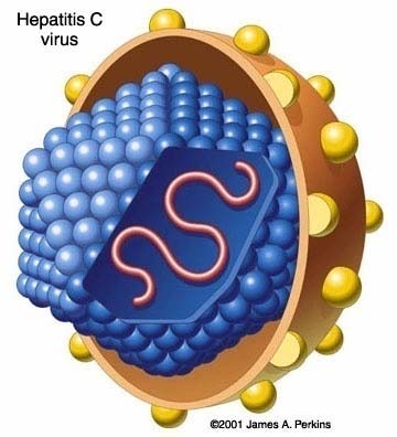 Hepatite C : Doença infecciosa viral, contagiosa, causada pelo vírus HCV, conhecido anteriormente por Hepatite não A não B, quando era responsável por 90% dos casos de Hepatite transmitida por