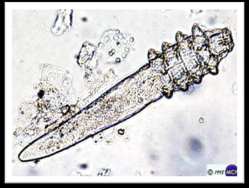 18 Figura 1- Demodex canis Fonte: http://www.infoescola.com/doencas/sarna-demodecica-canina/ O ciclo biológico se processa todo no hospedeiro e compreende: ovo, larva, protoninfa, ninfa e adulto (Fig.