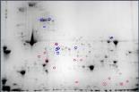 Análise de múltiplos genes investigando Responders vs. Non-responders Keller P et al.