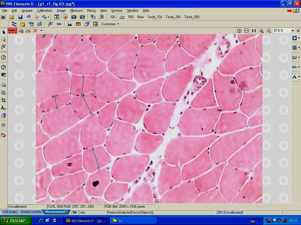 38 Figura 15: Imagem do software NIS-Elements D3.0 - SP7 (Nikon ) demonstrando medidas de menor diâmetro das fibras musculares. 4.10.