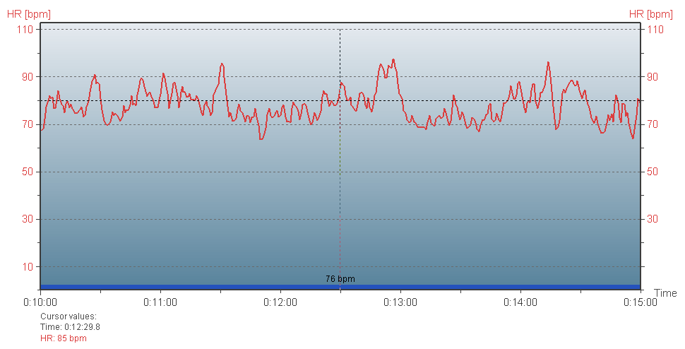 eletrocardiograma, com uma frequência de amostragem de 500 Hz e uma resolução temporal de 1 ms (RUHA e cols.