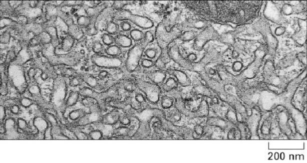 RETÍCULO ENDOPLASMÁTICO LISO REL célula de Leidig, secreta testosterona maioria tipos celulares - REL pouco abundante e restringe-se ao RE de transição (local de brotamento de vesículas para o