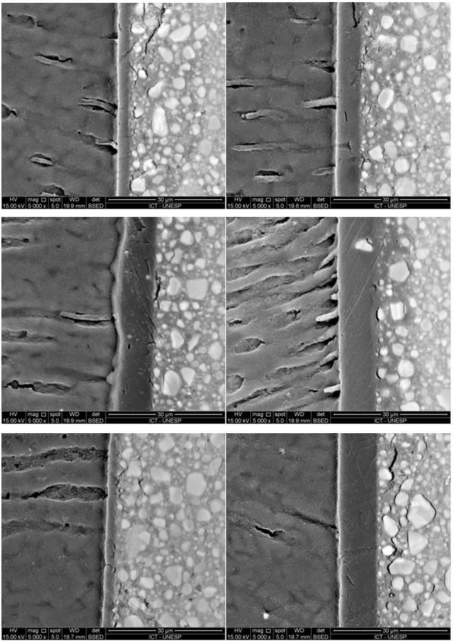 64 5.3 Avaliação da microscopia eletrônica de varredura (MEV) As imagens que se seguem representam uma amostragem dos grupos deste estudo.