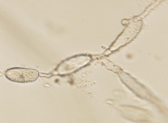 Embora se isolem diferentes Phytophthora spp. e Pythium spp.