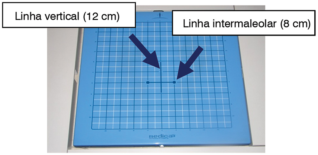 Este equipamento inclui um computador com o software da BRU TM, estrutura de segurança (estrutura metálica e arnês), plataforma de força, óculos de realidade virtual, acelerômetro e almofada de