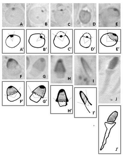 Fig.2- Montagem fotográfica contendo os dez passos acrossomais, de acordo com o método do sistema acrossômico, dos estádios do ciclo do epitélio seminífero em jaguatirica (Leopardus pardalis).