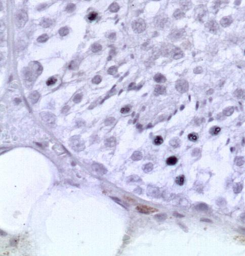 Assim, ao coletar os fragmentos testiculares em um período de tempo conhecido após a injeção de BrdU, e identificar as células imunomarcadas mais avançadas no epitélio seminífero destes animais, é