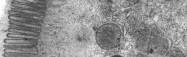 Questão Internet: <www.cytochemistry.net/cell-biology> Nas figuras acima, as setas indicam dois tipos de especialização da membrana plasmática.